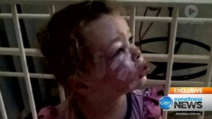 Two-year-old Ariana is recovering in hospital following the attack Photo: Ten News